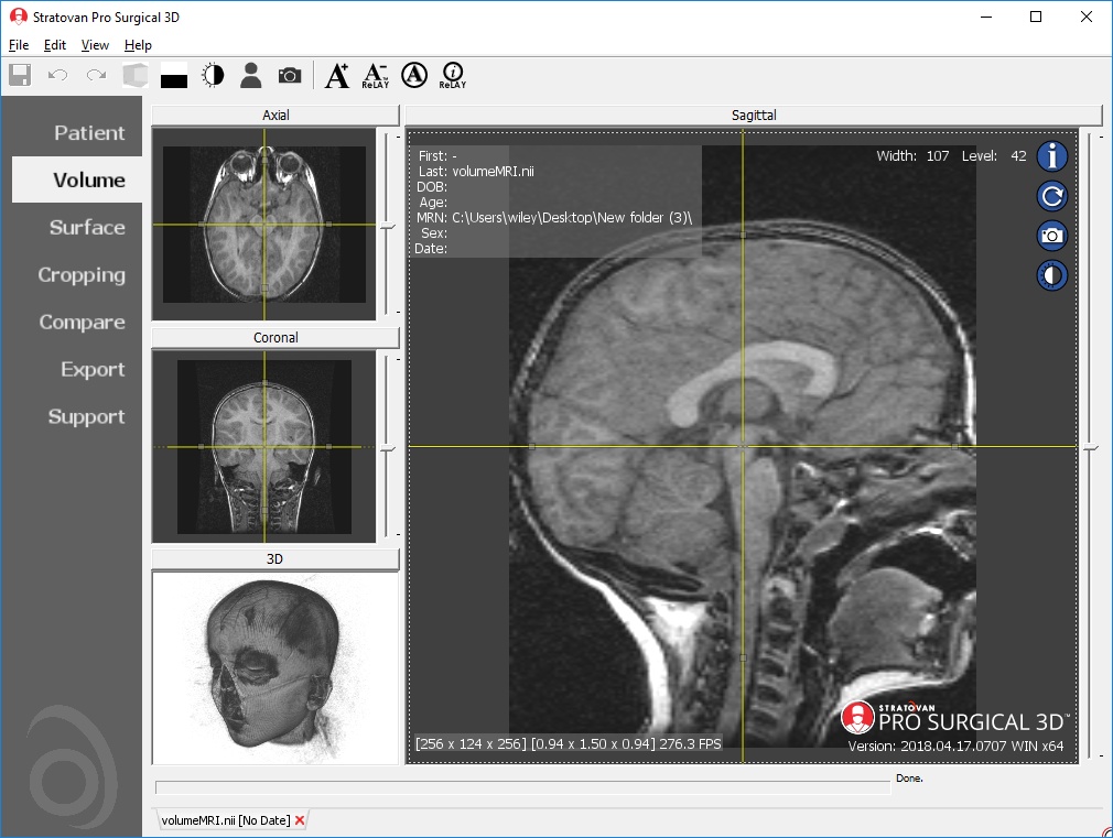 free ct imaging viewer for mac