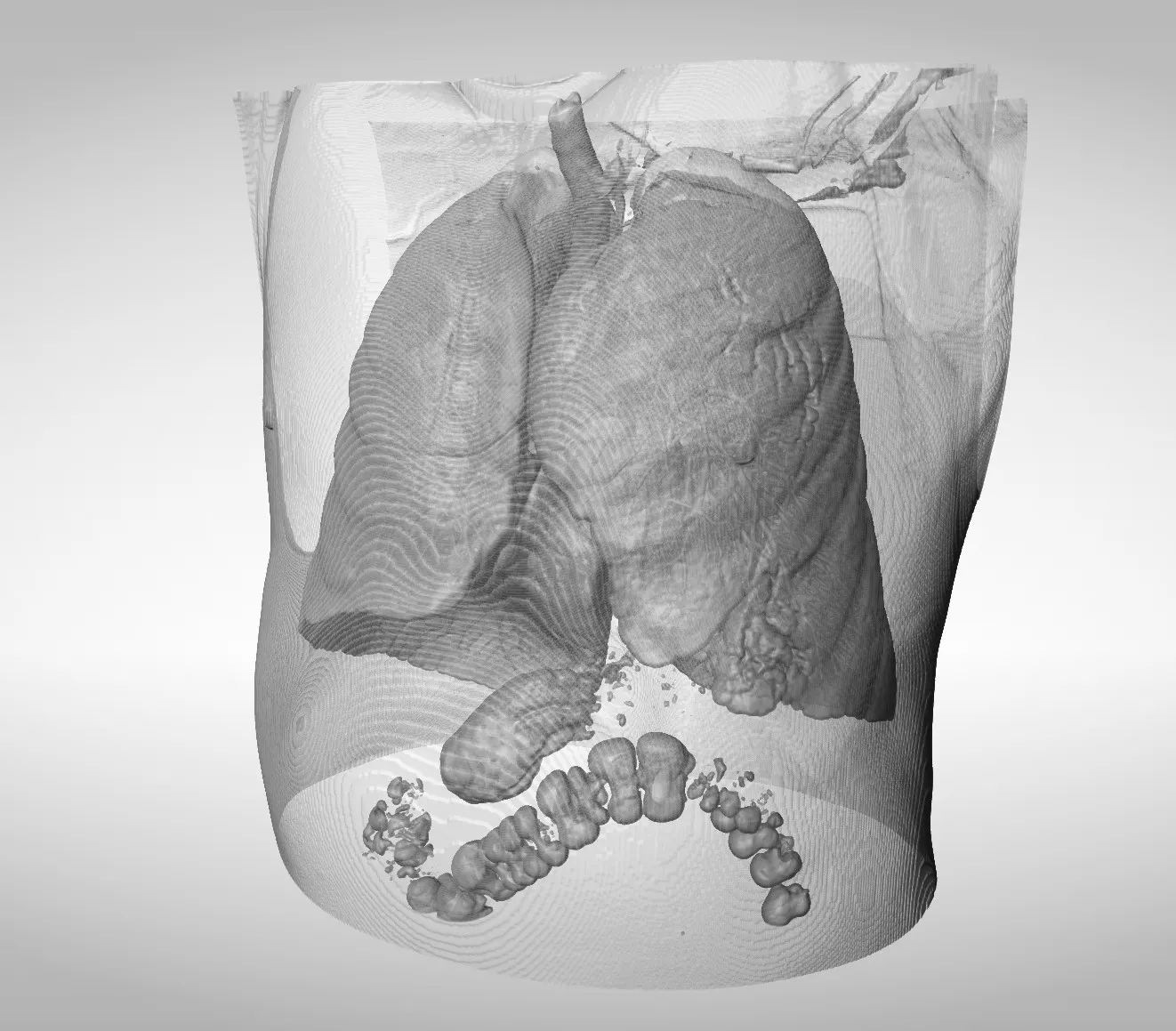 3D rendering of chest CT scan showing lungs and bowels